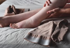Lymphoedema